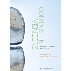 Composite Veneers: The Direct-Indirect Technique