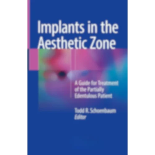 Implants in the Aesthetic Zone A Guide for Treatment of the Partially Edentulous Patient Implants in the Aesthetic Zone: A Guide for Treatment of the Partially Edentulous Patient