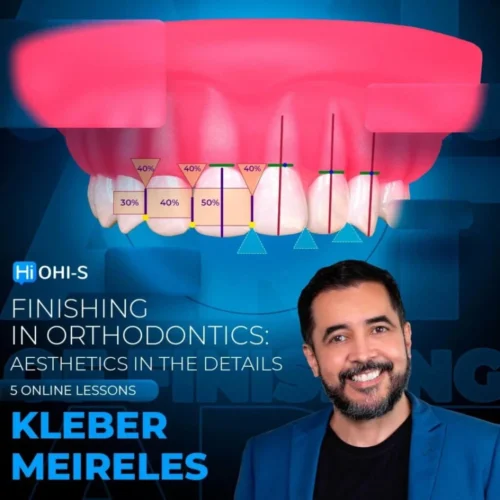OHI-S Finishing in orthodontics aesthetics in the details – Kleber Meireles OHI-S Finishing in orthodontics: aesthetics in the details – Kleber Meireles