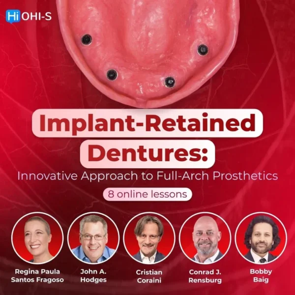 OHI-S Implant-Retained Dentures Innovative Approach to Full-Arch Prosthetics OHI-S Implant-Retained Dentures Innovative Approach to Full-Arch Prosthetics