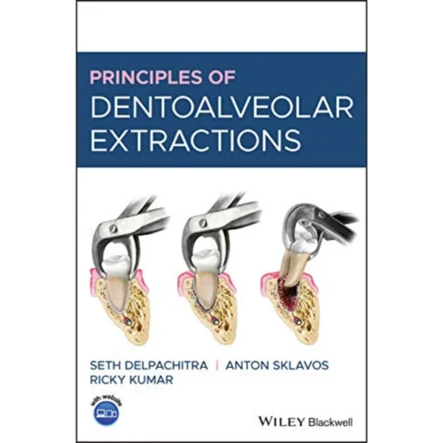 Principles of Dentoalveolar Extractions Principles of Dentoalveolar Extractions