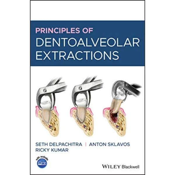 Principles of Dentoalveolar Extractions Principles of Dentoalveolar Extractions
