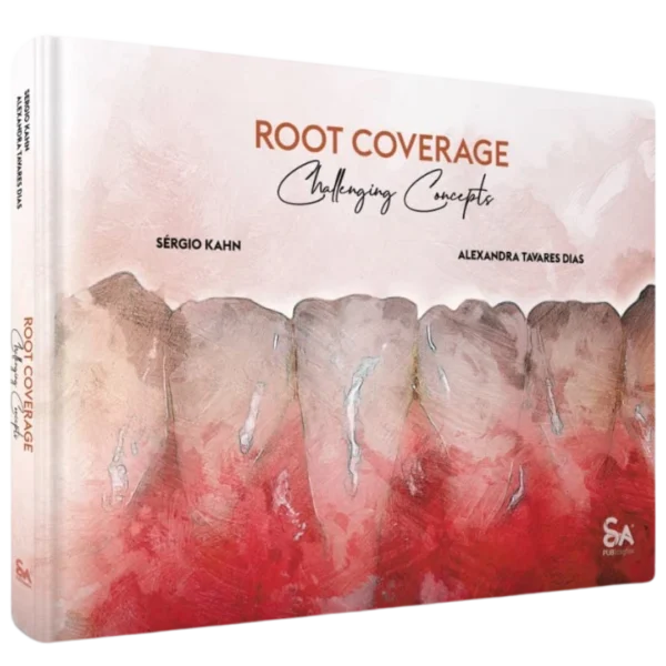 Root Coverage – Challenging Concepts Root Coverage – Challenging Concepts