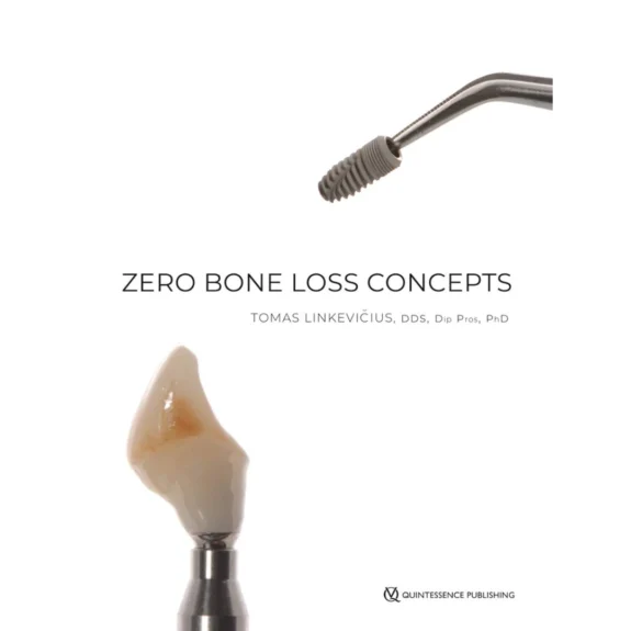 Zero Bone Loss Concepts Zero Bone Loss Concepts