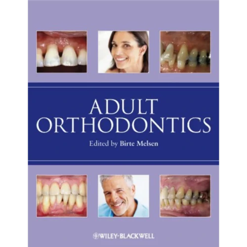 Adult Orthodontics Adult Orthodontics