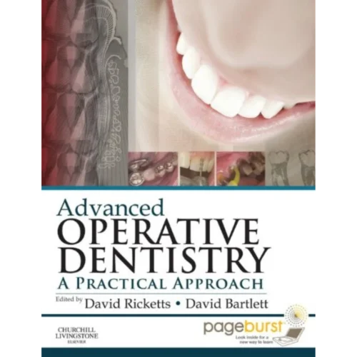 Advanced Operative Dentistry Advanced Operative Dentistry