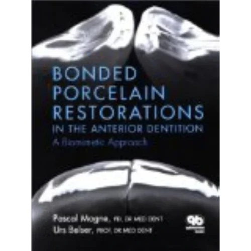 Bonded Porcelain Restorations in the Anterior Dentition Bonded Porcelain Restorations in the Anterior Dentition