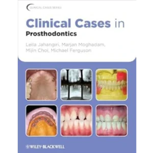 Clinical Cases in Prosthodontics (Clinical Cases (Dentistry) Book