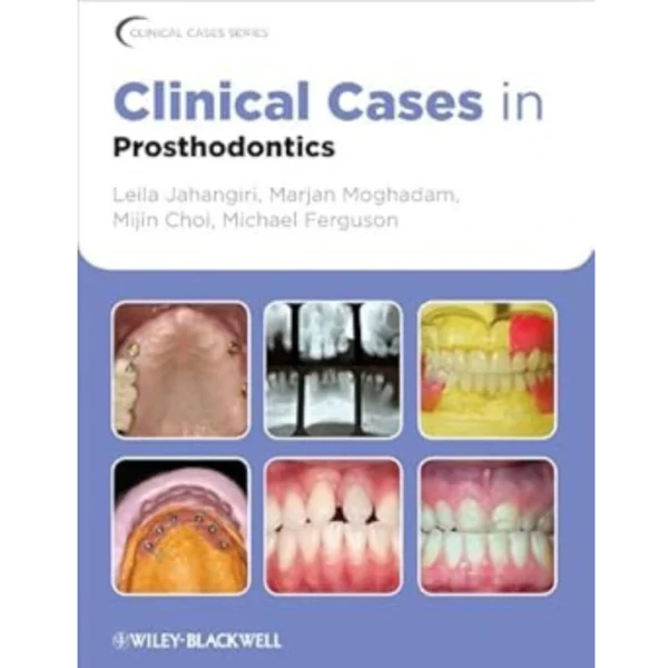 Clinical Cases in Prosthodontics (Clinical Cases (Dentistry) Book