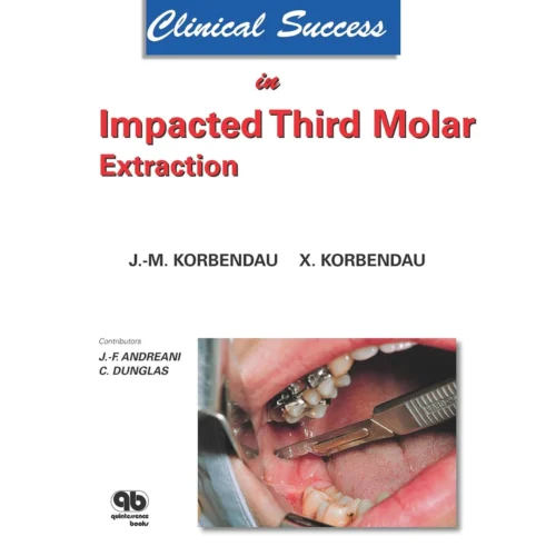 Clinical Success in Impacted Third Molar Extraction Clinical Success in Impacted Third Molar Extraction