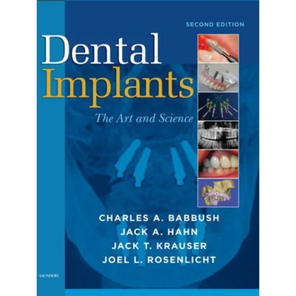 Dental Implants The Art and Science Dental Implants: The Art and Science