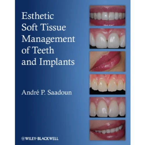 Esthetic Soft Tissue Management of Teeth and Implants Esthetic Soft Tissue Management of Teeth and Implants