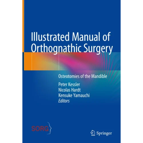 Illustrated Manual of Orthognathic Surgery Osteotomies of the Mandible Illustrated Manual of Orthognathic Surgery: Osteotomies of the Mandible