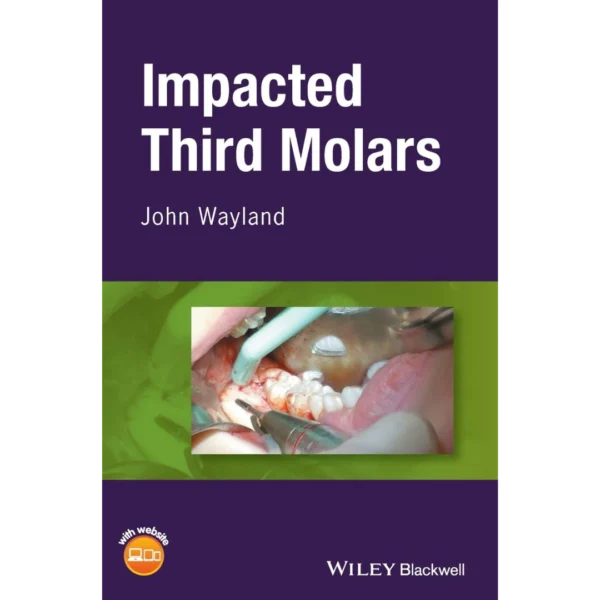 Impacted Third Molars Impacted Third Molars