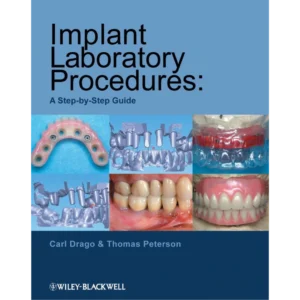 Implant Laboratory Procedures A Step-by-Step Guide