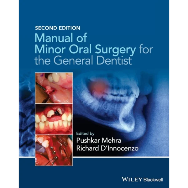 Manual of Minor Oral Surgery for the General Dentist