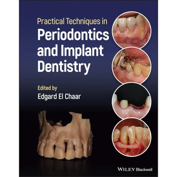 Practical Techniques in Periodontics and Implant Dentistry