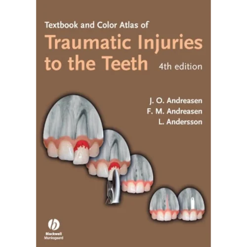 Textbook And Color Atlas Of Traumatic Injuries To The Teeth Textbook And Color Atlas Of Traumatic Injuries To The Teeth