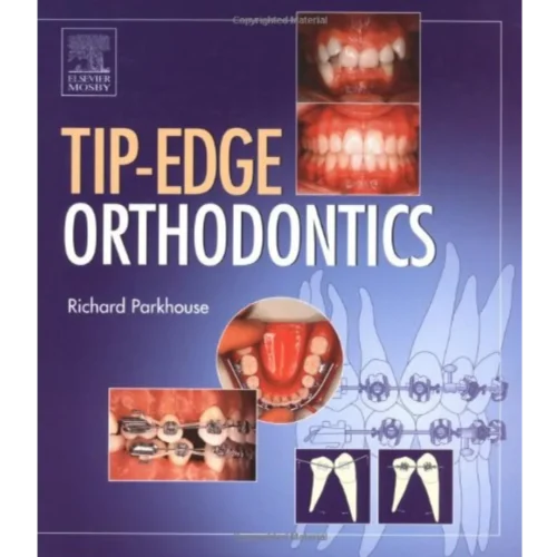 The Tip-Edge Orthodontic System The Tip-Edge Orthodontic System