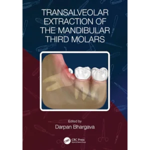 Transalveolar Extraction of the Mandibular Third Molars