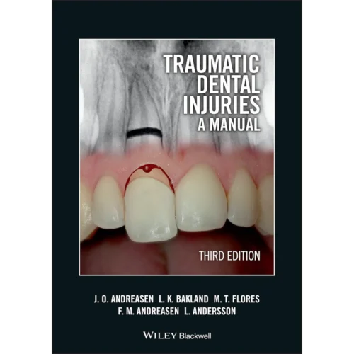 Traumatic Dental Injuries Traumatic Dental Injuries