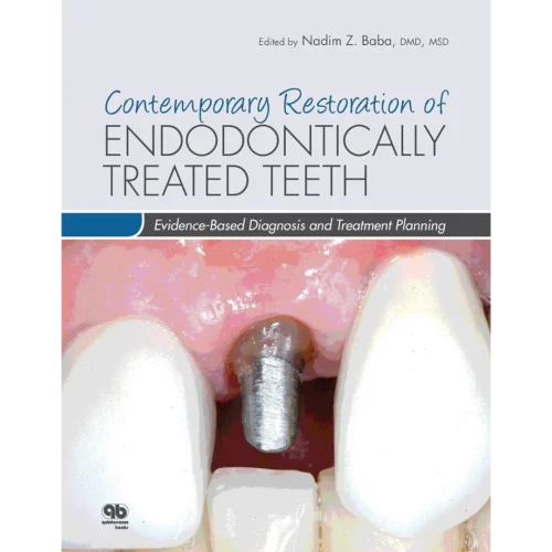 Contemporary Restoration of Endodontically Treated Teeth Contemporary Restoration of Endodontically Treated Teeth