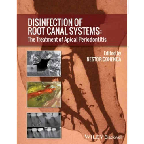 Disinfection of Root Canal Systems Disinfection of Root Canal Systems