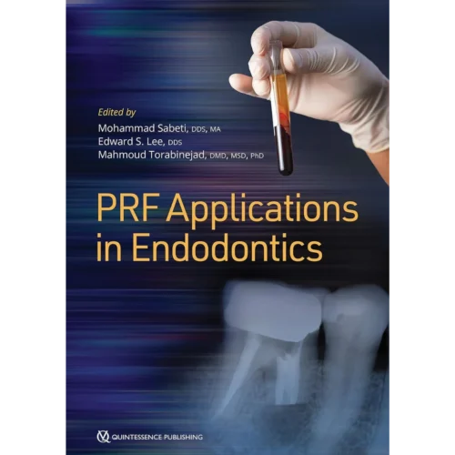 PRF Applications in Endodontics PRF Applications in Endodontics