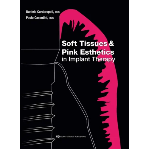 Soft Tissues and Pink Esthetics in Implant Therapy Soft Tissues and Pink Esthetics in Implant Therapy