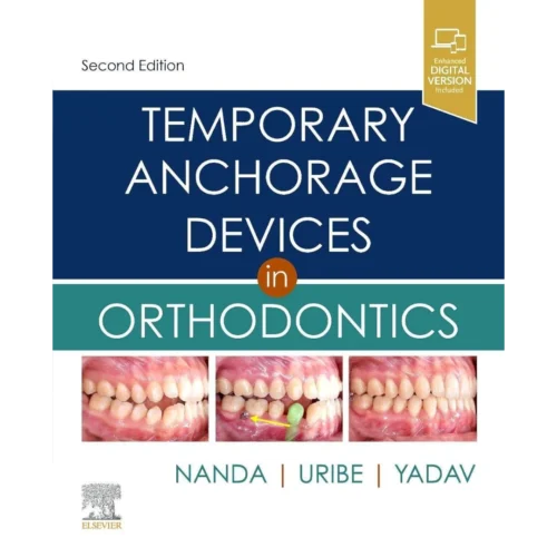 Temporary Anchorage Devices in Orthodontics 2nd Edition Temporary Anchorage Devices in Orthodontics 2nd Edition