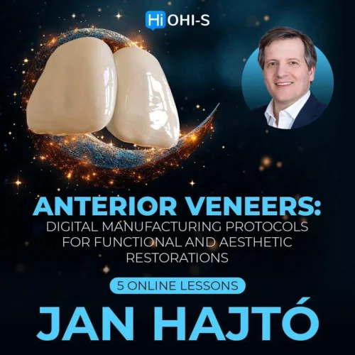 Anterior Veneers Digital Manufacturing Protocols for Functional and Aesthetic Restorations Anterior Veneers: Digital Manufacturing Protocols for Functional and Aesthetic Restorations