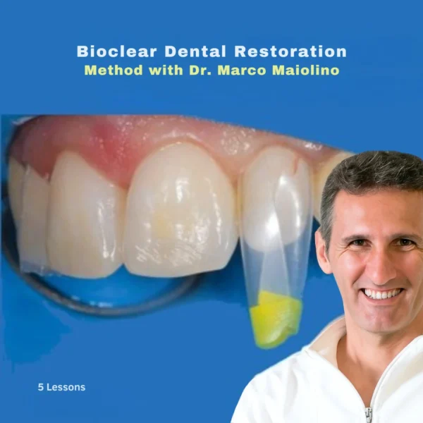 Bioclear Dental Restoration Bioclear Dental Restoration