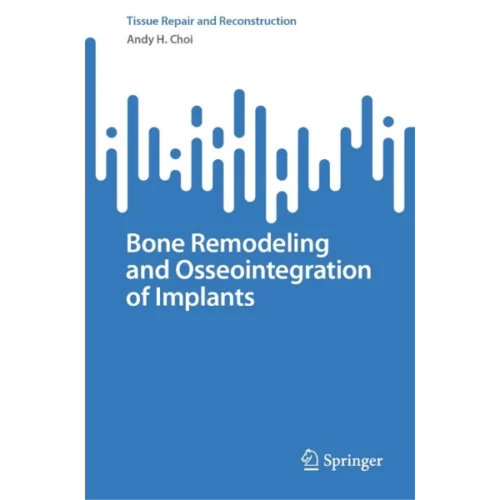 Bone Remodeling and Osseointegration of Implants Bone Remodeling and Osseointegration of Implants