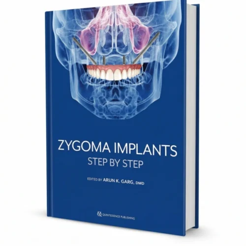 Zygoma -Implants Step by- Step Zygoma Implants: Step by Step