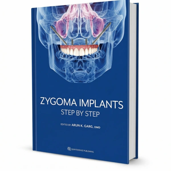 Zygoma Implants: Step by Step