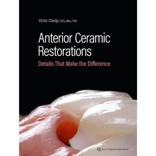 Anterior Ceramic Restorations: Details That Make the Difference