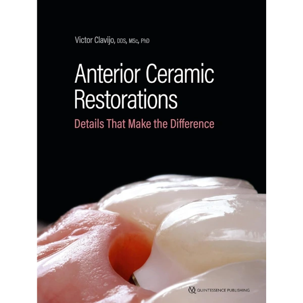 Anterior Ceramic Restorations: Details That Make the Difference
