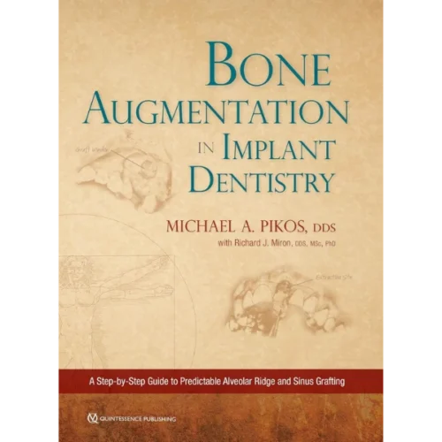 Bone Augmentation in Implant Dentistry: A Step-by-step Guide to Predictable Alveolar Ridge and Sinus Grafting