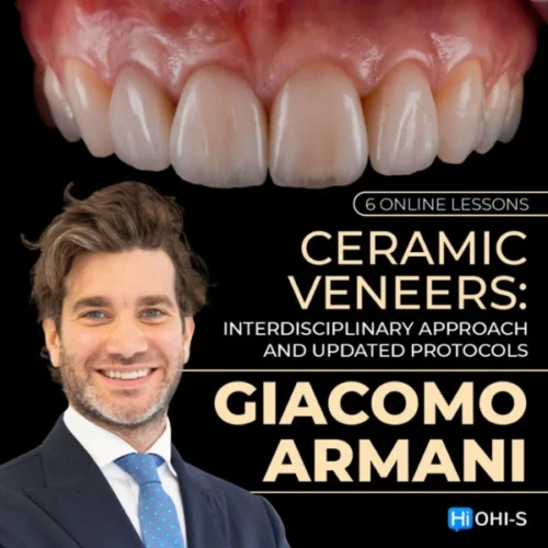 Ceramic Veneers Interdisciplinary Approach and Updated Protocols Ceramic Veneers: Interdisciplinary Approach and Updated Protocols