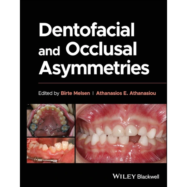 Dentofacial and Occlusal Asymmetries Dentofacial and Occlusal Asymmetries