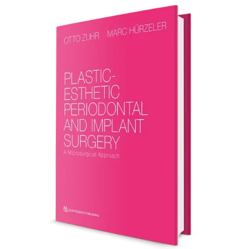 Plastic-Esthetic Periodontal and Implant Surgery A Microsurgical Approach Plastic-Esthetic Periodontal and Implant Surgery: A Microsurgical Approach