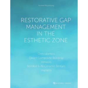 Restorative Gap Management in the Esthetic Zone: Orthodontics | Direct Composite Bonding | Veneers | Bonded & All-Ceramic Bridges | Implants