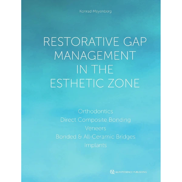 Restorative Gap Management in the Esthetic Zone: Orthodontics | Direct Composite Bonding | Veneers | Bonded & All-Ceramic Bridges | Implants