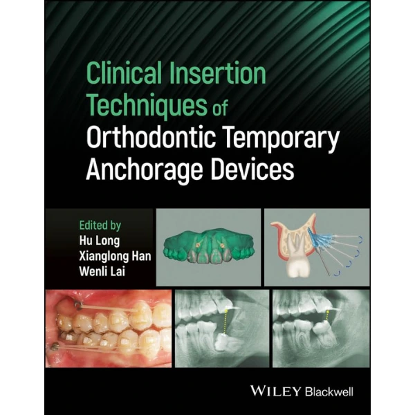 Clinical Insertion Techniques of Orthodontic Temporary Anchorage Devices Clinical Insertion Techniques of Orthodontic Temporary Anchorage Devices