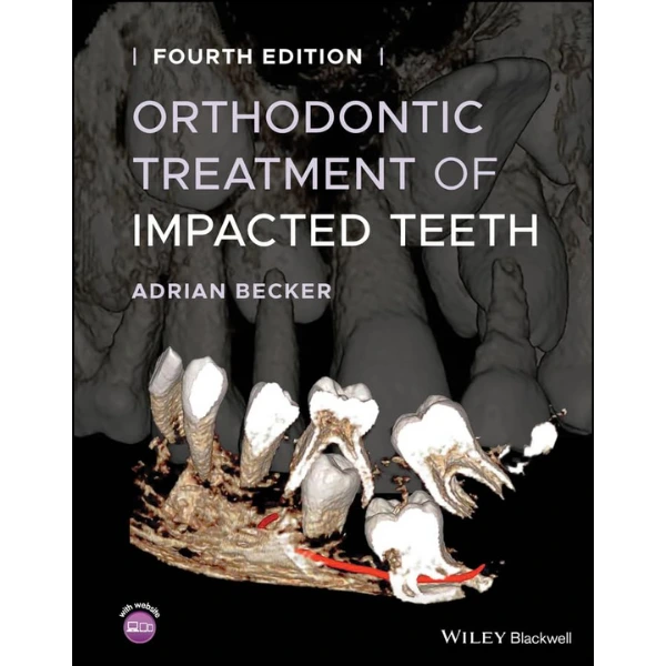 Orthodontic Treatment of Impacted Teeth