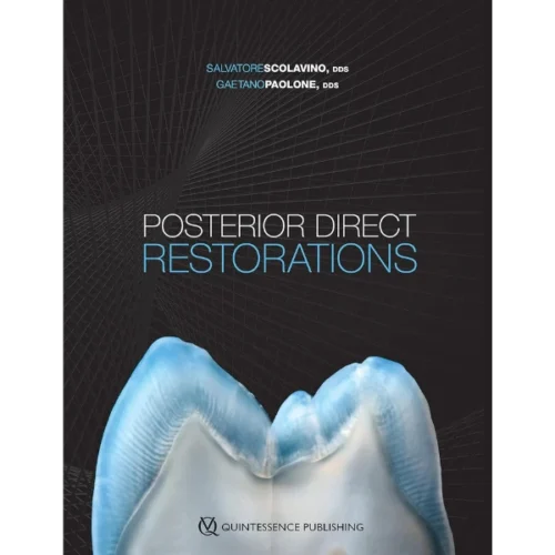 Posterior Direct Restorations Posterior Direct Restorations