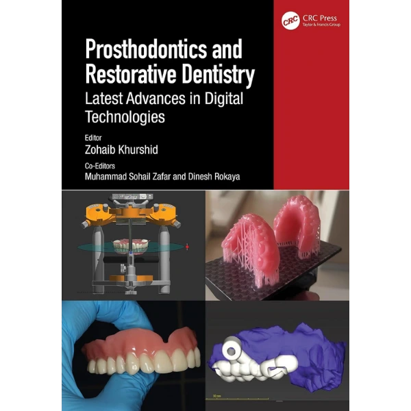 Prosthodontics and Restorative Dentistry: Latest Advances in Digital Technologies