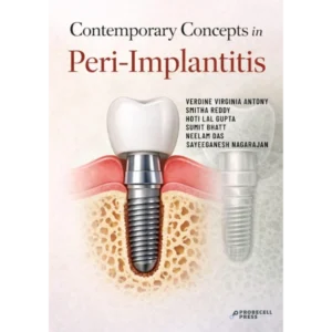 CONTEMPORARY CONCEPTS IN PERI-IMPLANTITIS