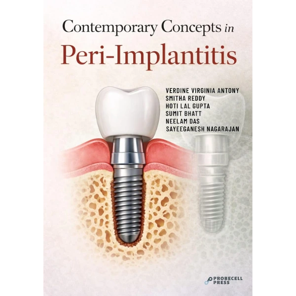 CONTEMPORARY CONCEPTS IN PERI-IMPLANTITIS