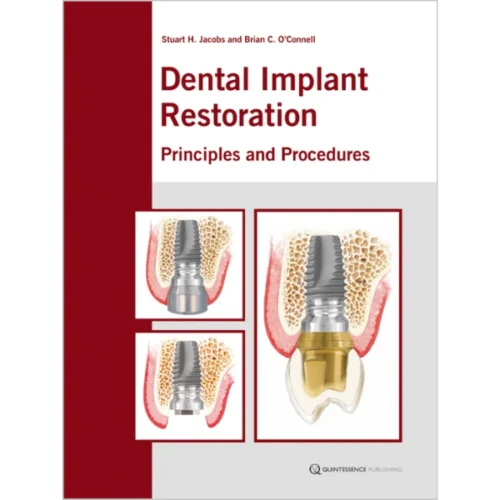 Dental Implant Restoration Principles and Procedures Dental Implant Restoration Principles and Procedures